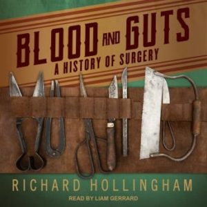 Blood and Guts: A History of Surgery